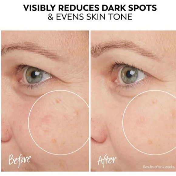 New Olay Pro-X Spot Fading Skincare Treatment - Picture 5 of 9